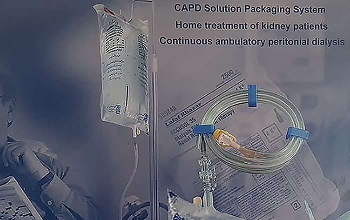 Continuous Ambulatory Peritoneal Dialysis (CAPD)